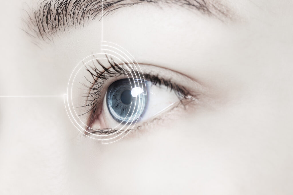 Cirurgia refrativa x lentes de contato: qual é a melhor escolha para você?